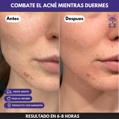 ClearAcne® - Pack 120 Parches Antigranos invisibles